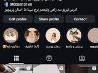 اپیلاسیون بانوان